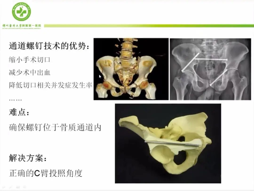 聚焦顯微外科|葫蘆島市醫(yī)學(xué)會(huì)顯微外科學(xué)分會(huì)第一屆第二次學(xué)術(shù)會(huì)議順利召開(圖11)